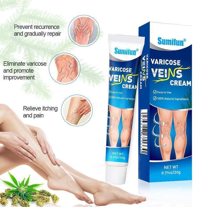 Vericose vein cream (Restore normal blood flow)